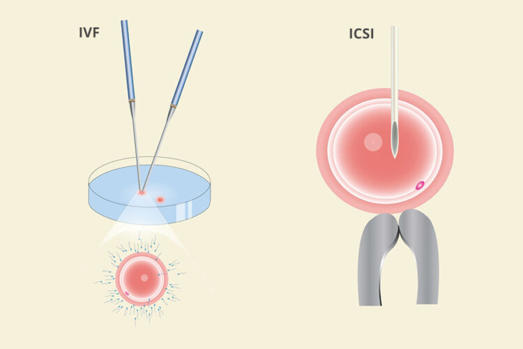 IVF En ICSI Vruchtbaarheidsbehandelingen – 24Baby.nl