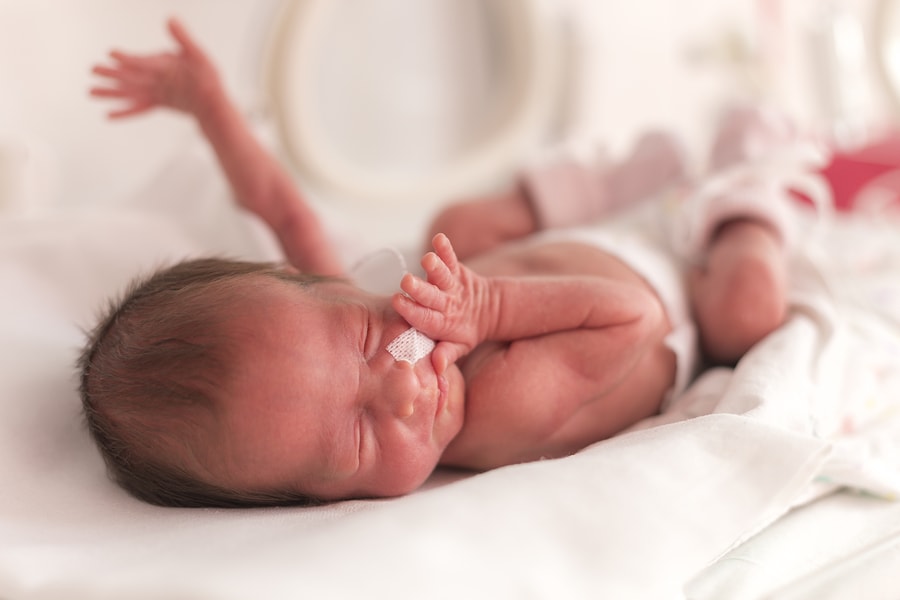 Met 33 Weken Kwam Mijn Kindje Ter Wereld 24Baby nl