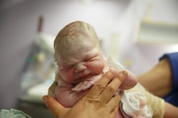 Pasgeboren nog verfrommelde baby, bedekt met vernix