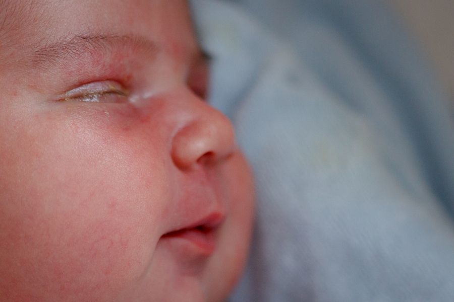 Zwaaien thuis Zogenaamd Ontstoken oog bij je baby: ernstig of niet? – 24Baby.nl