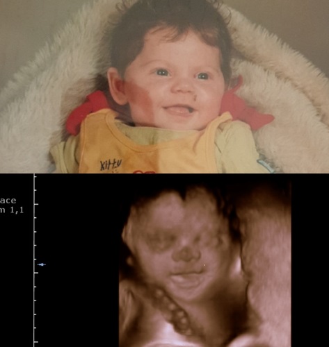 LisaaF en baby in buik