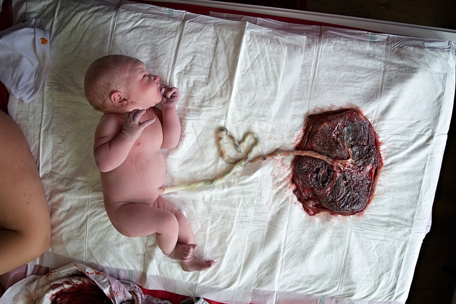 De Placenta Moederkoek 24baby Nl