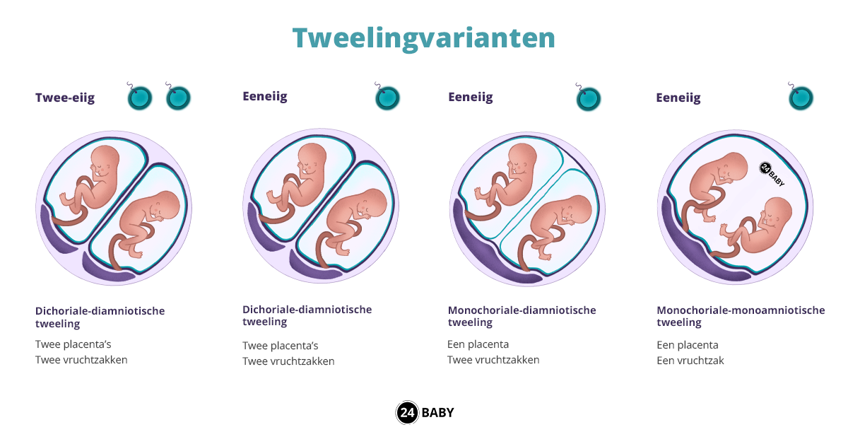 Tweelingzwangerschap Dubbel Zoveel Geluk 24baby Nl