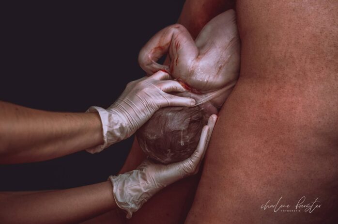 Baby wordt door verloskundige aangepakt