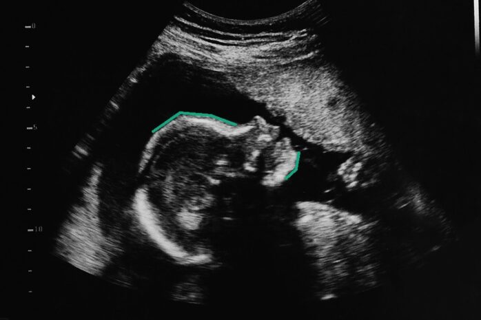 Echo van wat volgens skull-theorie een jongen is