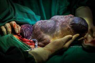 Pasgeboren baby in vruchtzak