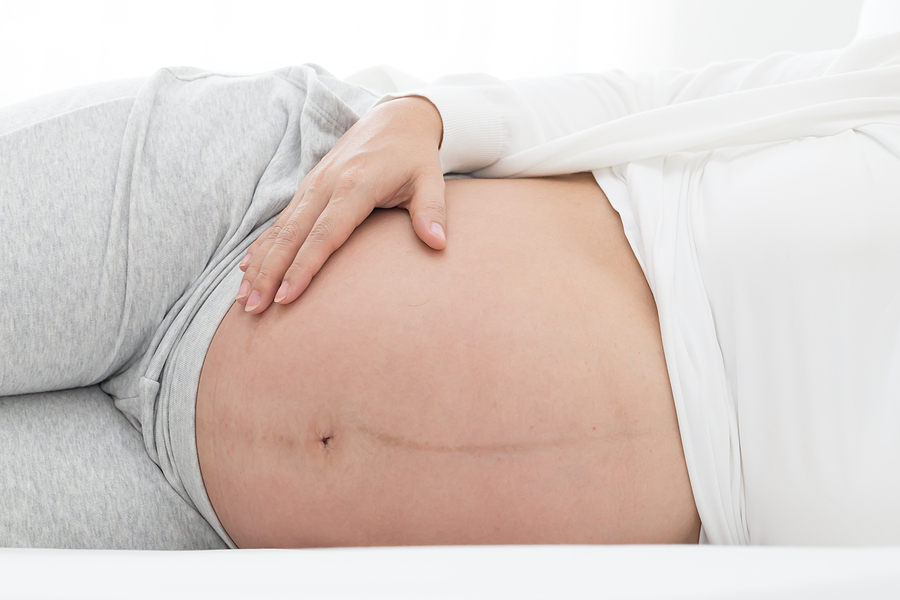 Ab wann verfärben sich die brustwarzen in der schwangerschaft