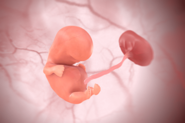 Baby 3D in der 8. SSW
