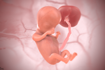10. SSW Baby 3D