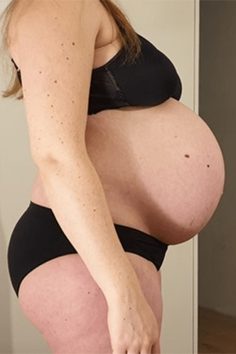 40. SSW Babybauch