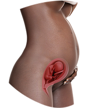 24. SSW Babybauch