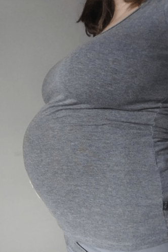 32. SSW Babybauch