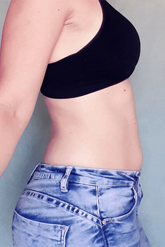 babybauch 11. SSW
