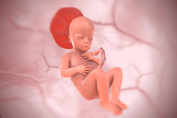 19. SSW Baby in 3D