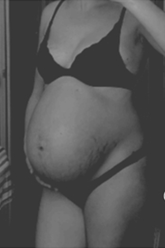 42. SSW babybauch