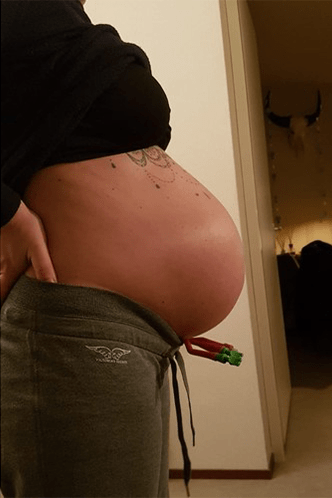 42. SSW babybauch
