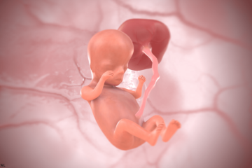 11. SSW Baby in 3D