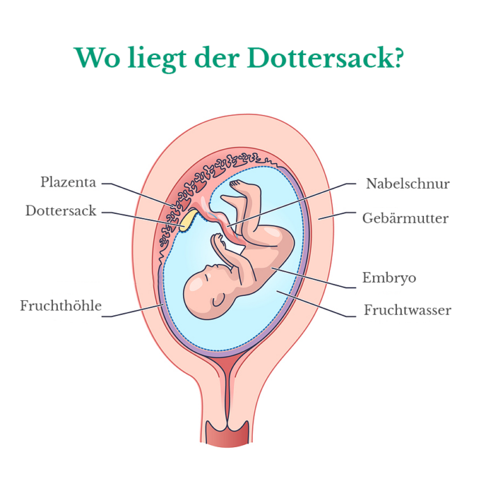 Infographik: Wo befindet sich der Dottersack?