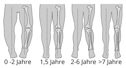 Infographik über die Entwicklung des Beins.