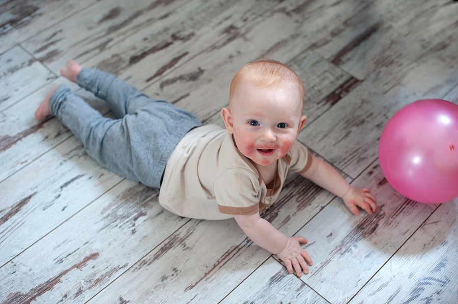 Baby mit Neurodermitis liegt auf dem Boden und spielt mit einem Luftballon