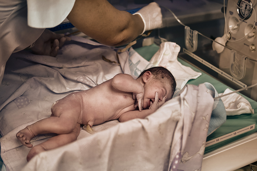 Baby wird für die U1-Untersuchung untersucht.
